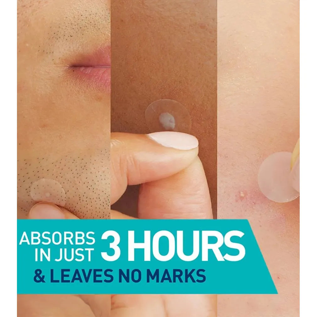 CeraVe Blemish Barrier Patch, 22 count-3606000641839-LR-359187-2-LR eShop