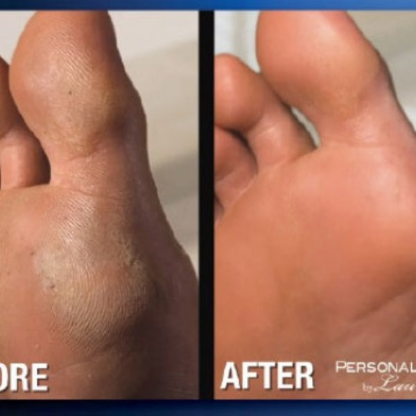 Emson Personal Pedi Foot Care System by Laurant-080313097546-LR-352813-4-LR eShop