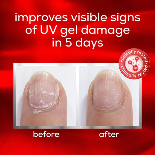 essie Nail Care To The Rescue UV Gel Damage Repair Nail Repair Treatment-095008062600-LR-356263-3-LR eShop