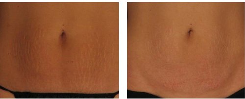 Instituto Espanol Avena Collagen Regeneration Cream, 6.8 oz-818821001362-LR-355672-5-LR eShop