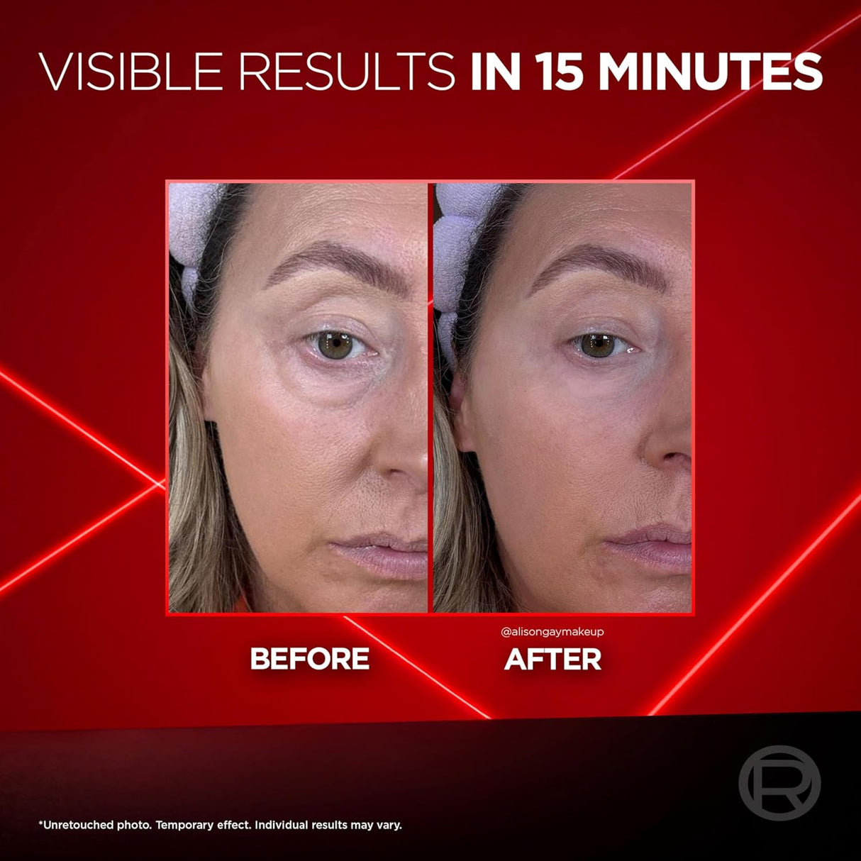 L'ORÉAL PARIS Revitalift Laser Instant Eye Bag Eraser. 0.5 oz-3600524231392-LR-360960-3-LR eShop