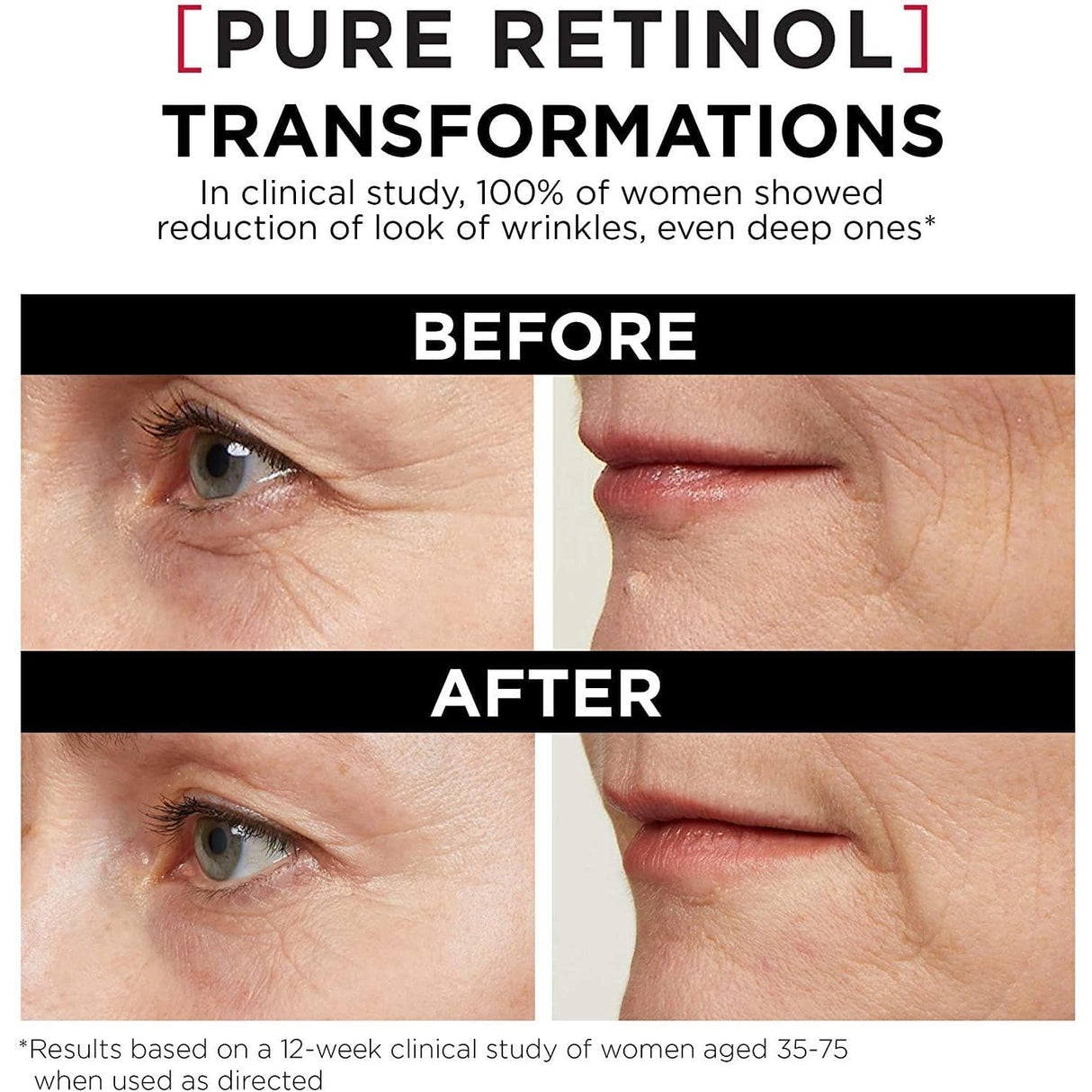 L'ORÉAL PARIS Revitalift Triple Power LZR Pure Retinol Night Serum, 1 fl oz-071249419182-LR-338719-4-LR eShop