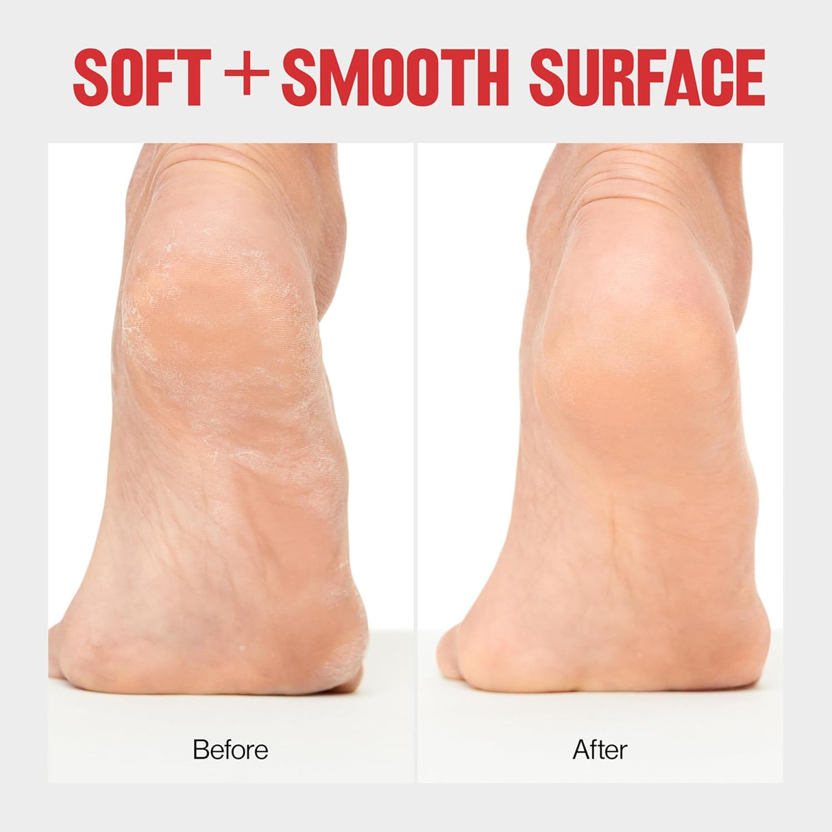 REVLON Callus Remover With Catcher-309975420623-LR-293466-5-LR eShop