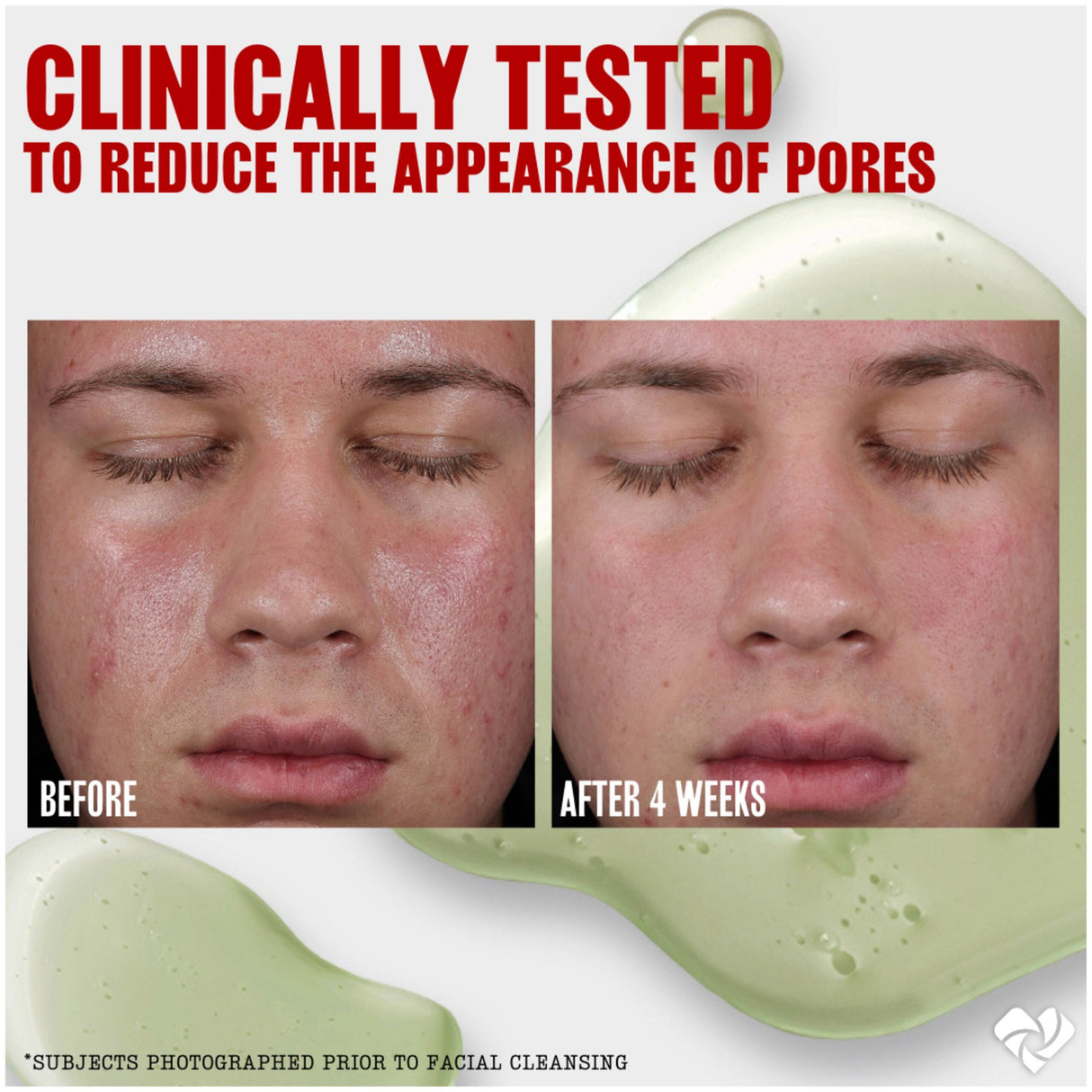 Thayers Alcohol-Free Witch Hazel Facial Mist Toner with Aloe Vera, Unscented-041507070288-LR-355902-8-LR eShop