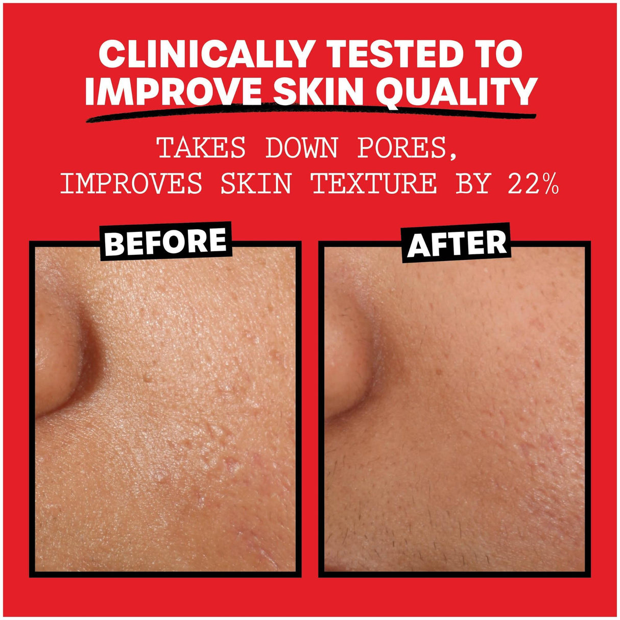 Thayers Natural Remedies Witch Hazel Alcohol Free Toner with Rose Petal-041507070134-LR-355898-2-LR eShop