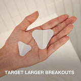 Neutrogena Stubborn Acne Ultra-Thin Blemish Patches, 10 count-070501064382-LR-358666-4-LR eShop