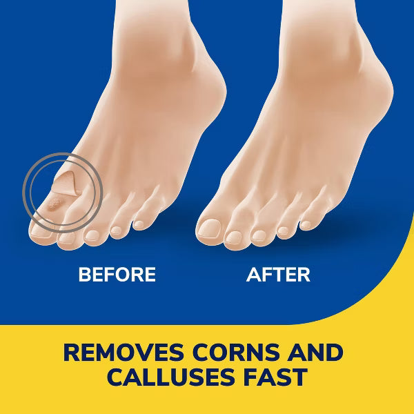 Dr. Scholl's Liquid Corn and Callus Remover, 0.33 oz