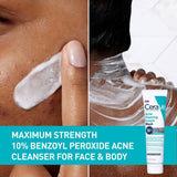 CeraVe Acne Control Foaming Face Cleanser - 10% Benzoyl Peroxide, 5 oz