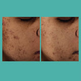 L'ORÉAL PARIS Bright Reveal Niacinamide Dark Spot Serum, 1 fl oz