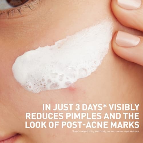 CeraVe Acne Clay-to-Foam Facial Cleanser, 4 oz – L&R eShop
