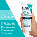 CeraVe Acne Clay-to-Foam Facial Cleanser, 4 oz-3606000636149-LR-359659-5-LR eShop