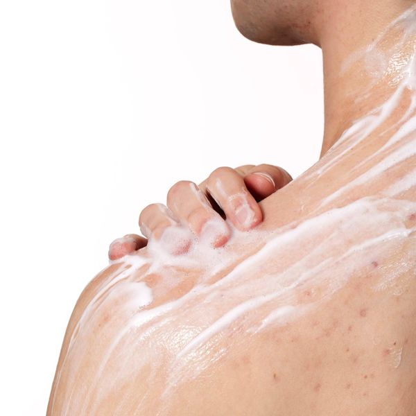 CeraVe Acne Control Foaming Face Cleanser - 10% Benzoyl Peroxide, 5 oz-3606000604520-LR-360785-8-LR eShop