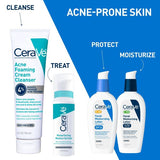 CeraVe Acne Foaming Cream Face Cleanser - Fragrance Free, 5 oz-3606000512238-LR-335880-6-LR eShop