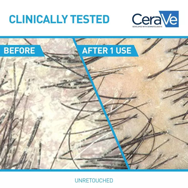 CeraVe Anti-Dandruff 2-in-1 Shampoo & Conditioner, 12 oz-3606000612266-LR-357368-4-LR eShop