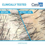 CeraVe Anti-Dandruff 2-in-1 Shampoo & Conditioner, 12 oz-3606000612266-LR-357368-4-LR eShop