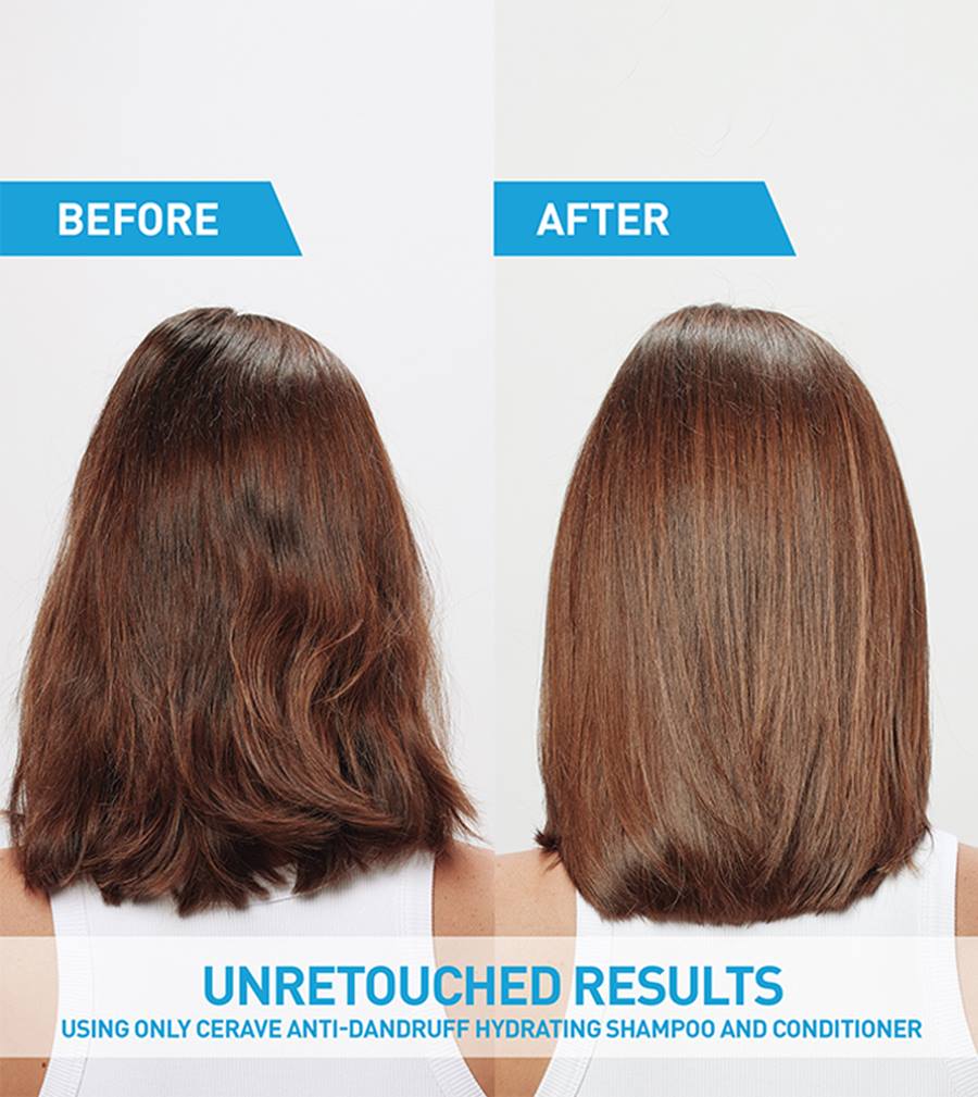 CeraVe Anti-Dandruff Hydrating Conditioner, 9 oz-3606000612242-LR-357367-5-LR eShop