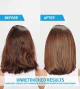 CeraVe Anti-Dandruff Hydrating Conditioner, 9 oz-3606000612242-LR-357367-5-LR eShop