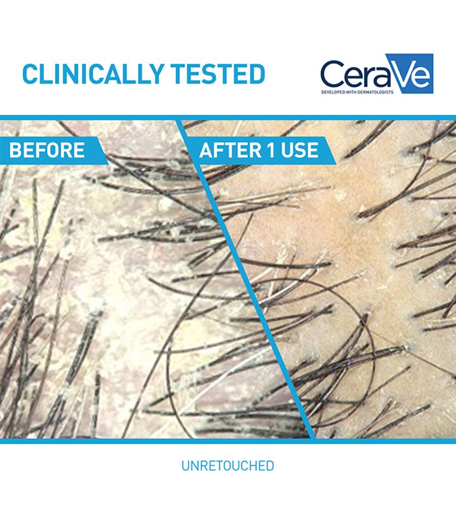 CeraVe Anti-Dandruff Hydrating Shampoo, 12 oz-3606000612228-LR-357366-5-LR eShop