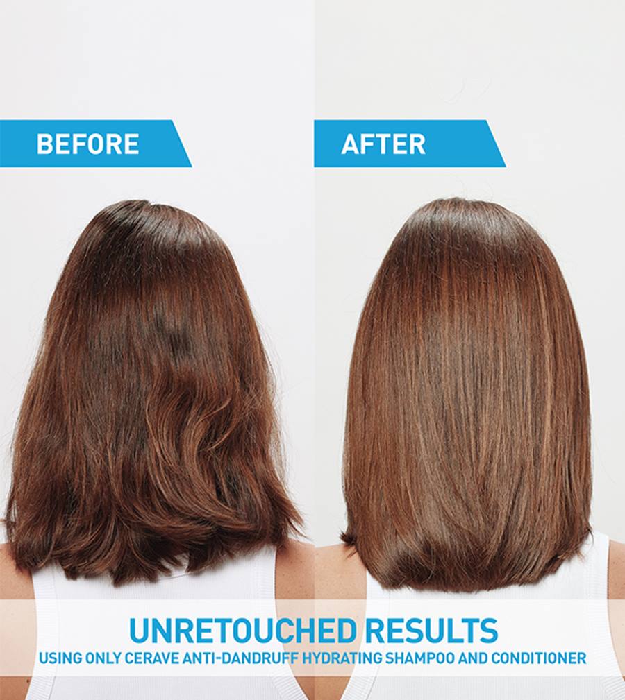 CeraVe Anti-Dandruff Hydrating Shampoo, 12 oz-3606000612228-LR-357366-6-LR eShop