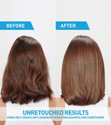 CeraVe Anti-Dandruff Hydrating Shampoo, 12 oz-3606000612228-LR-357366-6-LR eShop