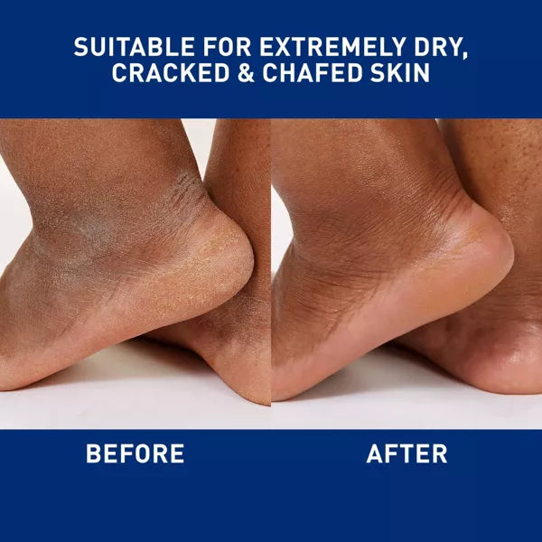 CeraVe Healing Ointment for Dry Skin, 3 oz-3606000537484-LR-319309-5-LR eShop