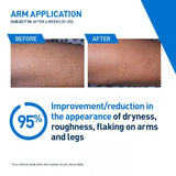 CeraVe Intensive Moisturizing Lotion For Dry to Very Dry Skin, 8 oz-3606000620841-LR-357210-7-LR eShop