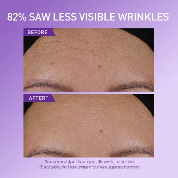 CeraVe Skin Renewing Super Boost Serum with 3 Essential Ceramides, 1.7 oz-3606000660779-LR-362876-4-LR eShop