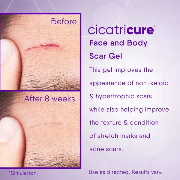cicatricure Face and Body Scar Gel, 1 oz-650240028090-LR-318063-4-LR eShop