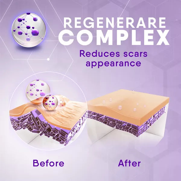 cicatricure Face and Body Scar Gel, 1 oz-650240028090-LR-318063-5-LR eShop