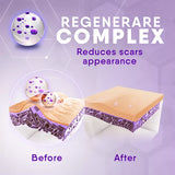 cicatricure Face and Body Scar Gel, 1 oz-650240028090-LR-318063-5-LR eShop