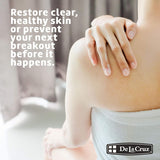 De La Cruz Maximum Strength Acne Treatment, 2.6 oz-024286150426-LR-224691-3-LR eShop