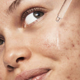 e.l.f. SKIN Blemish Breakthrough Triple-Acid Resurfacing Serum-609332575622-LR-347924-12-LR eShop