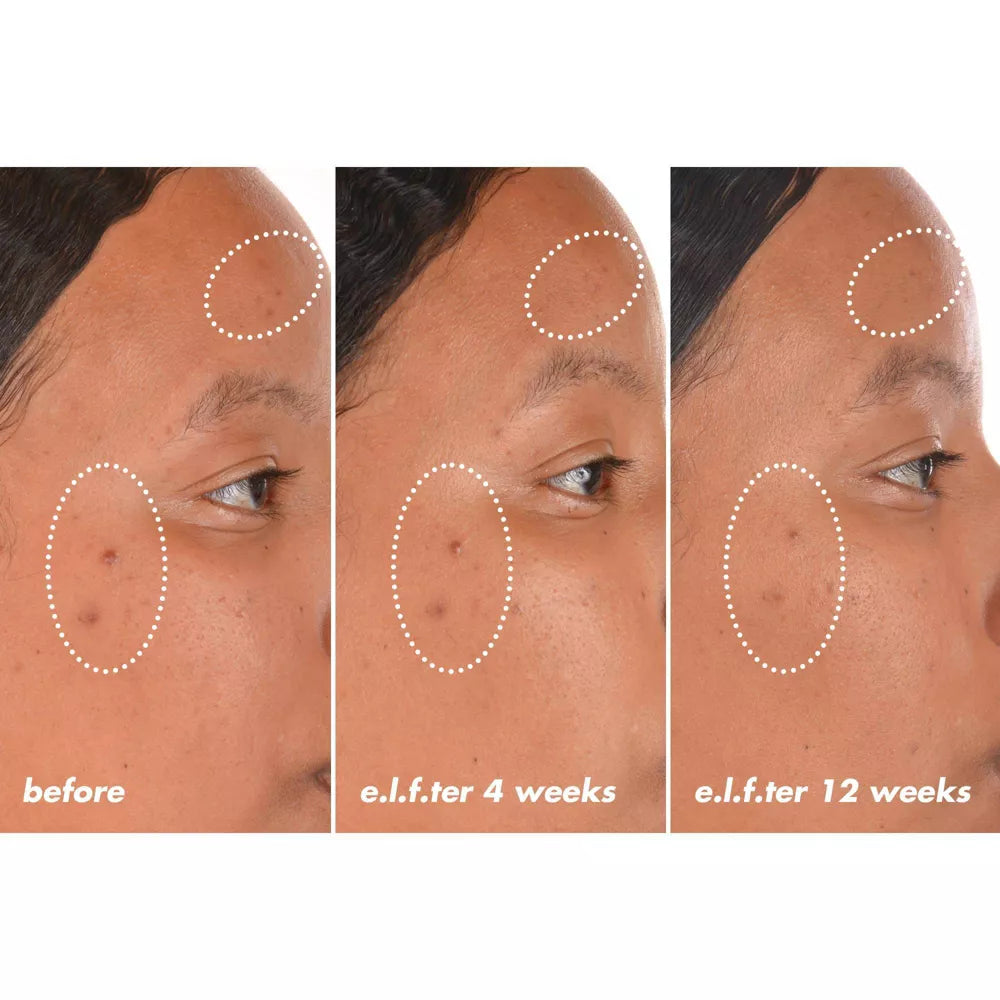 e.l.f. SKIN Bright Icon Vitamin C + E + Ferulic Face Serum, 1 oz-609332576155-LR-360227-5-LR eShop