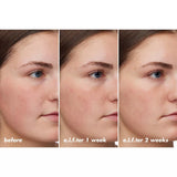 e.l.f. SKIN Holy Hydration! Barrier Goals Repair Cream, 2.1 oz-609332574014-LR-360224-5-LR eShop