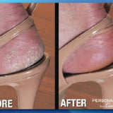 Emson Personal Pedi Foot Care System by Laurant-080313097546-LR-352813-3-LR eShop