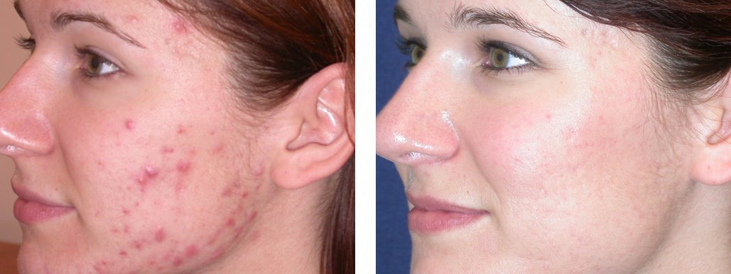 Instituto Espanol Avena Collagen Regeneration Cream, 6.8 oz-818821001362-LR-355672-3-LR eShop