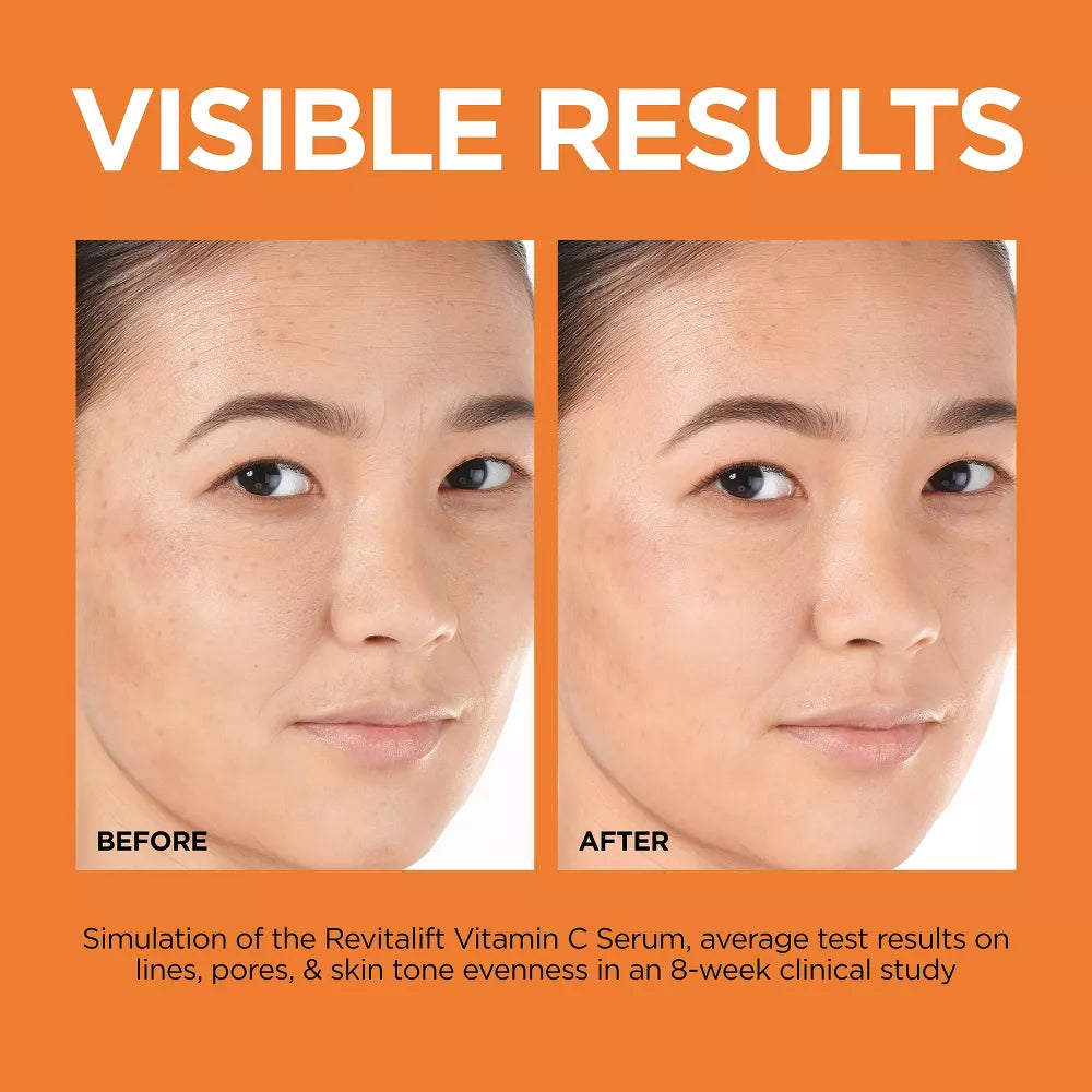 L'ORÉAL PARIS Revitalift 12% Vitamin C + E + Salicylic Serum, 1 fl. oz.-3600524053352-LR-352493-5-LR eShop