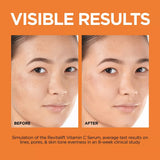 L'ORÉAL PARIS Revitalift 12% Vitamin C + E + Salicylic Serum, 1 fl. oz.-3600524053352-LR-352493-5-LR eShop