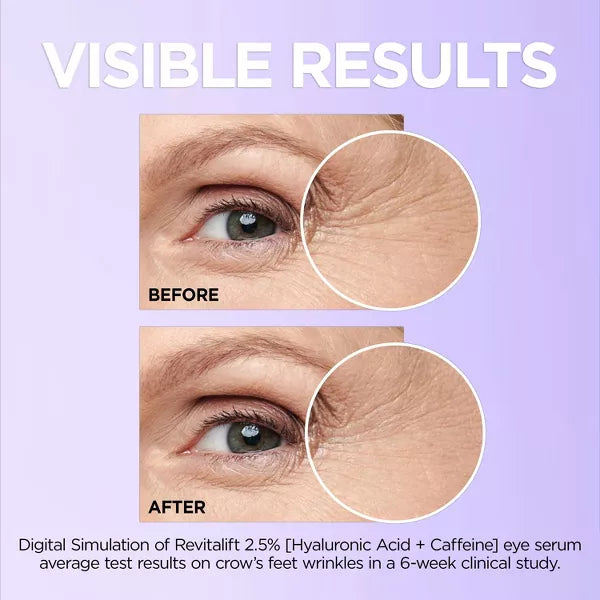 L'ORÉAL PARIS Revitalift Derm Intensives Hyaluronic Acid and Caffeine Eye Serum, 0.67 fl oz-071249635452-LR-344017-7-LR eShop