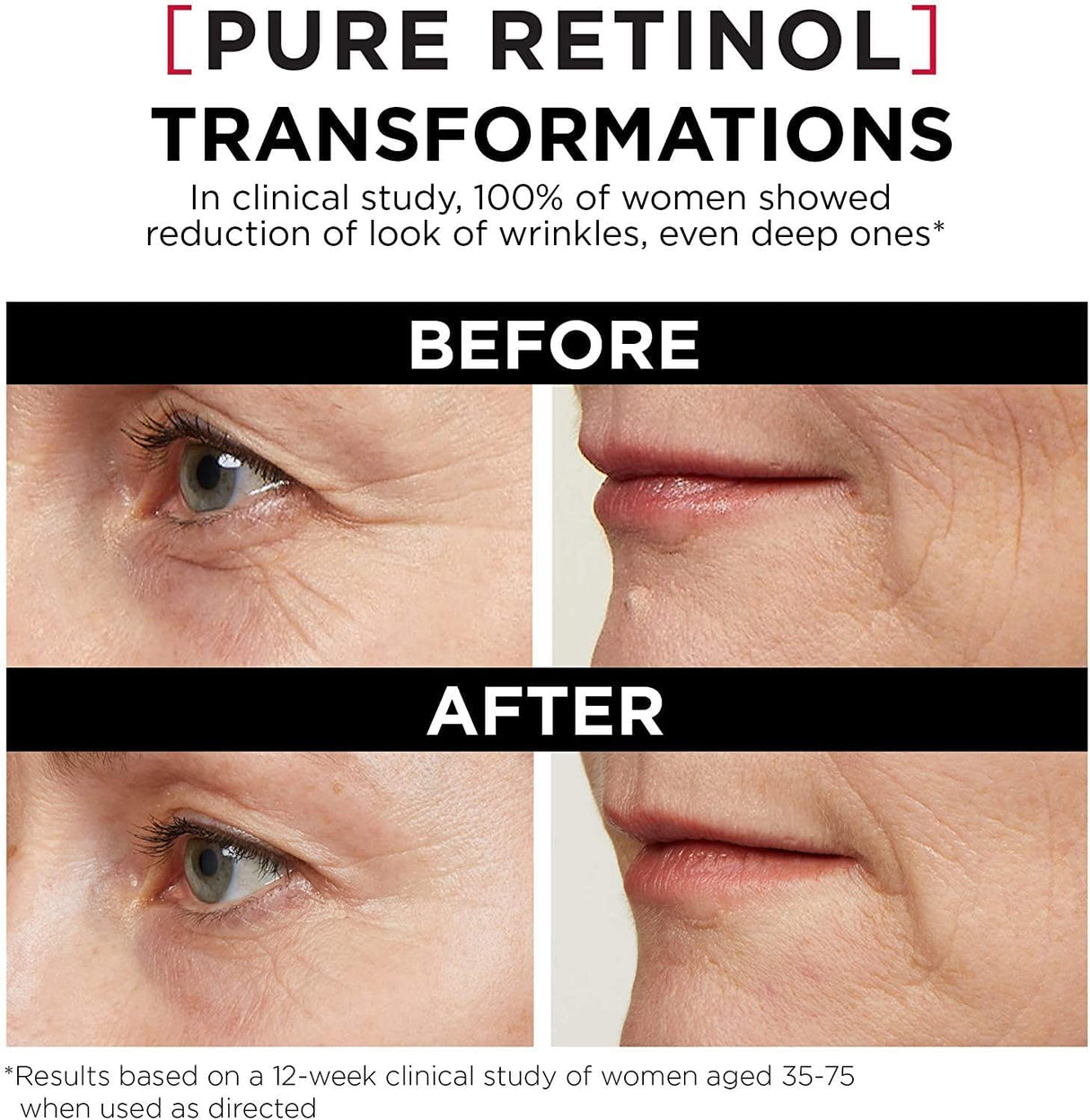 L'ORÉAL PARIS Revitalift Triple Power LZR Pure Retinol Night Serum, 1 fl oz-071249419182-LR-338719-4-LR eShop