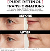 L'ORÉAL PARIS Revitalift Triple Power LZR Pure Retinol Night Serum, 1 fl oz-071249419182-LR-338719-4-LR eShop