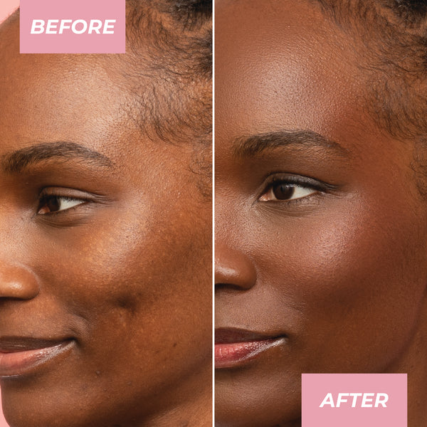 MCoBeauty Miracle Hyaluronic Tinted Serum - 10-12 deep-9331880017309-LR-355756-7-LR eShop