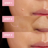 MCoBeauty Miracle Pimple Patch-9331880022426-LR-353605-7-LR eShop