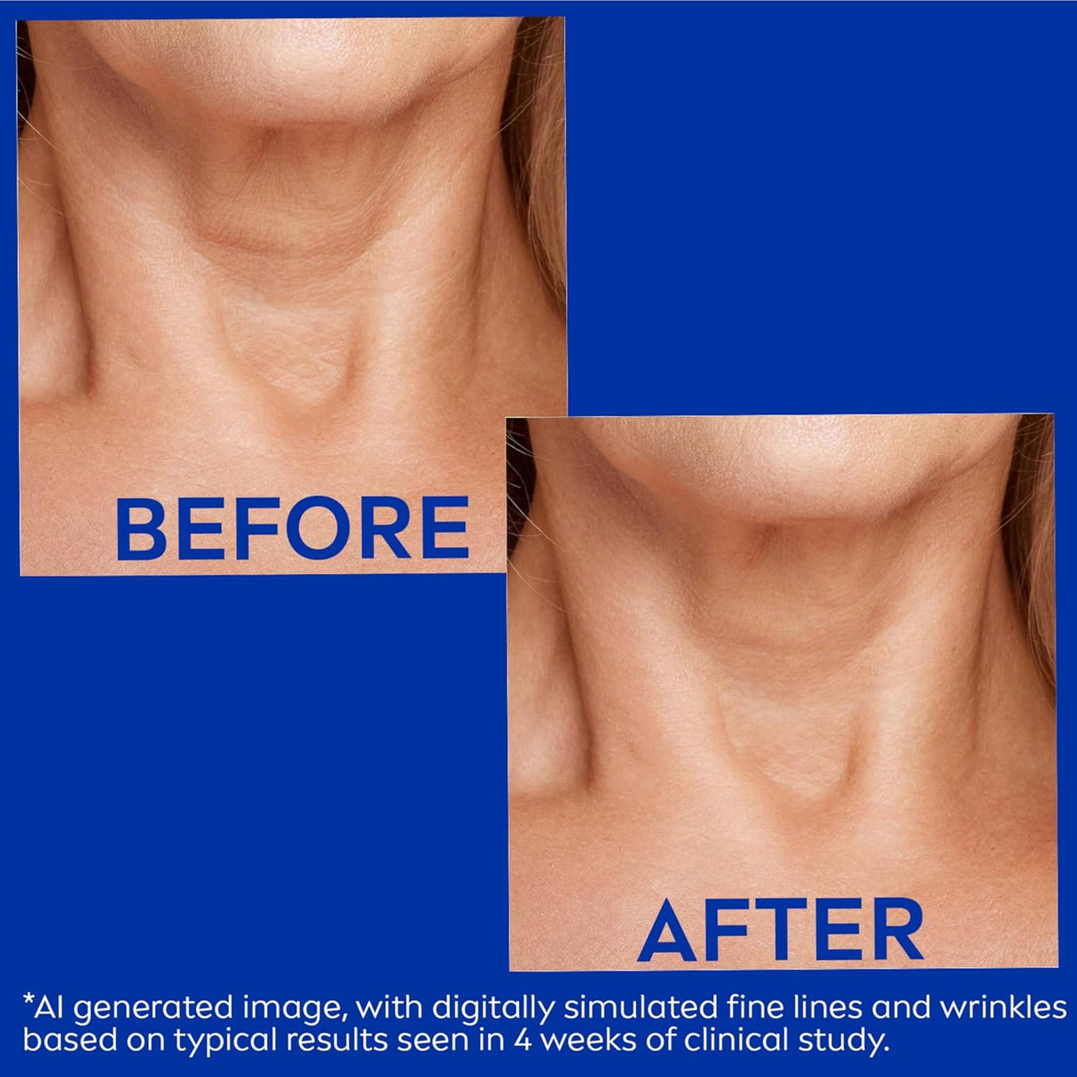NIVEA Skin Firming &amp; Anti-Wrinkle Neck & Chest Cream, 6.7 oz-072140037611-LR-362640-5-LR eShop