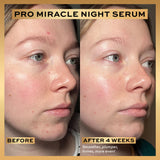 REVOLUTION Pro Miracle Night Rescue Serum Advanced Complex-5057566764513-LR-361425-6-LR eShop