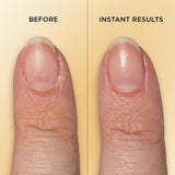 Sally Hansen Vitamin E Nail & Cuticle Treatment Pen-3616306830158-LR-360170-5-LR eShop