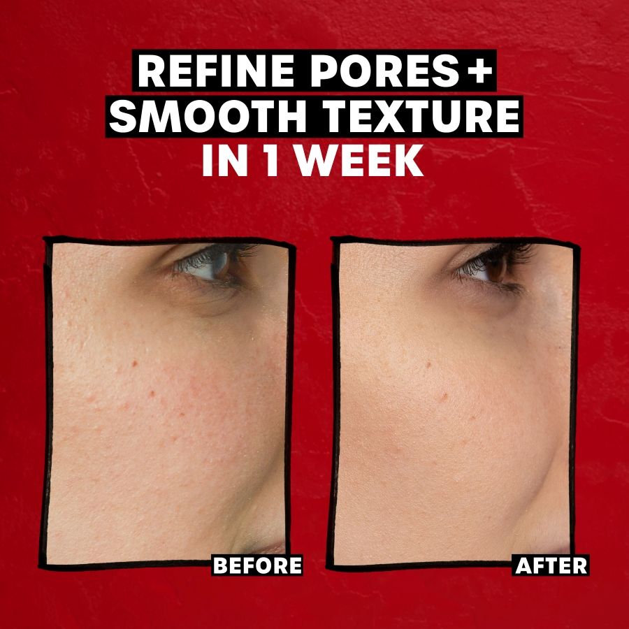 Thayers Exfoliating 2% Aha Toner, 8.5 oz-041507055056-LR-358748-4-LR eShop