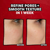 Thayers Exfoliating 2% Aha Toner, 8.5 oz-041507055056-LR-358748-4-LR eShop