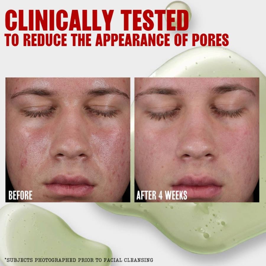 Thayers Oil Balancing Jelly Toner, 8.5 oz-041507053762-LR-359455-3-LR eShop